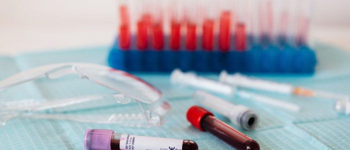 A Complete Guide To Selecting The Appropriate Drug Test Kit